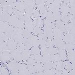 IYD Antibody in Immunohistochemistry (Paraffin) (IHC (P))