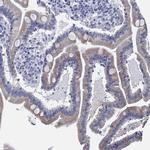 IYD Antibody in Immunohistochemistry (Paraffin) (IHC (P))