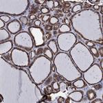 IYD Antibody in Immunohistochemistry (Paraffin) (IHC (P))