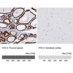 IYD Antibody in Immunohistochemistry (IHC)