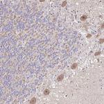 HCFC1R1 Antibody in Immunohistochemistry (Paraffin) (IHC (P))