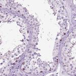 HHIPL2 Antibody in Immunohistochemistry (Paraffin) (IHC (P))