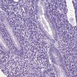 HHIPL2 Antibody in Immunohistochemistry (IHC)