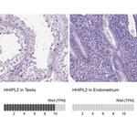 HHIPL2 Antibody