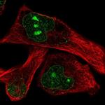 DOCK11 Antibody in Immunocytochemistry (ICC/IF)