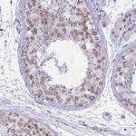 DOCK11 Antibody in Immunohistochemistry (Paraffin) (IHC (P))