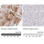 MYLK2 Antibody in Immunohistochemistry (IHC)