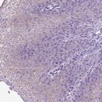 Periplakin Antibody in Immunohistochemistry (IHC)