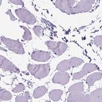 Periplakin Antibody in Immunohistochemistry (IHC)