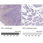 Periplakin Antibody