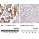 MYLK2 Antibody