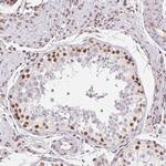 TREF1 Antibody in Immunohistochemistry (Paraffin) (IHC (P))