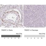 TREF1 Antibody in Immunohistochemistry (IHC)