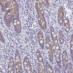 GLB1L2 Antibody in Immunohistochemistry (IHC)