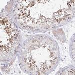 SPPL3 Antibody in Immunohistochemistry (Paraffin) (IHC (P))