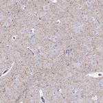 VGAT Antibody in Immunohistochemistry (IHC)