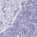 VGAT Antibody in Immunohistochemistry (IHC)