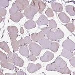 RAB43 Antibody in Immunohistochemistry (IHC)