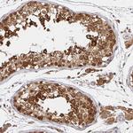 ALG1 Antibody in Immunohistochemistry (Paraffin) (IHC (P))