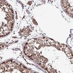 SEC63 Antibody in Immunohistochemistry (IHC)