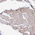 SEC63 Antibody in Immunohistochemistry (IHC)