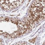 NAALAD2 Antibody in Immunohistochemistry (Paraffin) (IHC (P))