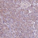 RRS1 Antibody in Immunohistochemistry (Paraffin) (IHC (P))