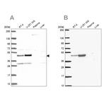 RRS1 Antibody in Western Blot (WB)