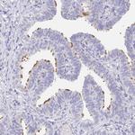 AKAP14 Antibody in Immunohistochemistry (Paraffin) (IHC (P))