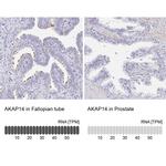 AKAP14 Antibody in Immunohistochemistry (IHC)