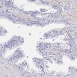 AKAP14 Antibody in Immunohistochemistry (IHC)