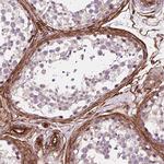 EGFL8 Antibody in Immunohistochemistry (Paraffin) (IHC (P))