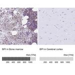 BPI Antibody in Immunohistochemistry (IHC)