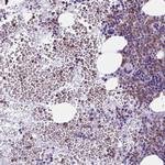 BPI Antibody in Immunohistochemistry (IHC)