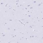 BPI Antibody in Immunohistochemistry (IHC)