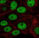 CD2BP2 Antibody in Immunocytochemistry (ICC/IF)