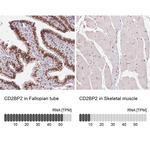 CD2BP2 Antibody in Immunohistochemistry (IHC)