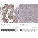 FARSB Antibody in Immunohistochemistry (IHC)