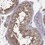 FARSB Antibody in Immunohistochemistry (IHC)