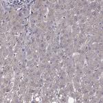 FARSB Antibody in Immunohistochemistry (IHC)