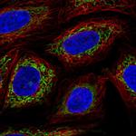 OXCT1 Antibody in Immunocytochemistry (ICC/IF)