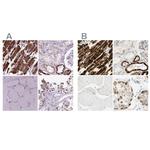 OXCT1 Antibody in Immunohistochemistry (IHC)