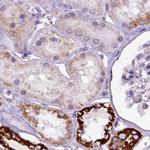 OXCT1 Antibody in Immunohistochemistry (IHC)