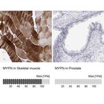 MYPN Antibody in Immunohistochemistry (IHC)