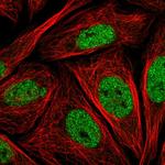 LMO4 Antibody in Immunocytochemistry (ICC/IF)