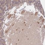 LMO4 Antibody in Immunohistochemistry (Paraffin) (IHC (P))