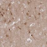 LMO4 Antibody in Immunohistochemistry (Paraffin) (IHC (P))