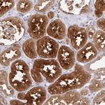 LMO4 Antibody in Immunohistochemistry (Paraffin) (IHC (P))