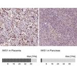 IWS1 Antibody in Immunohistochemistry (IHC)