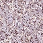 IWS1 Antibody in Immunohistochemistry (IHC)